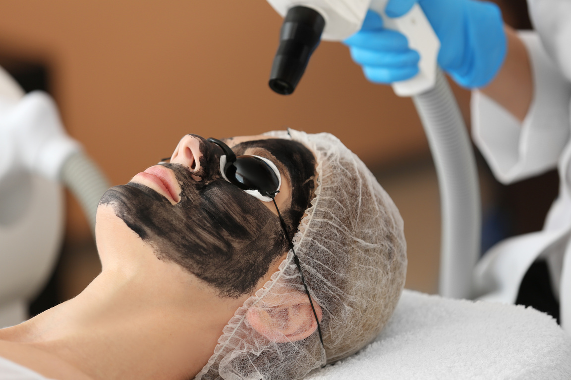 Woman Undergoing Carbon Peeling Procedure in a Salon